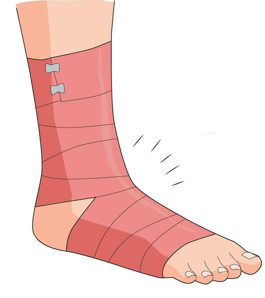 Fractured leg wrapped with bandage vector