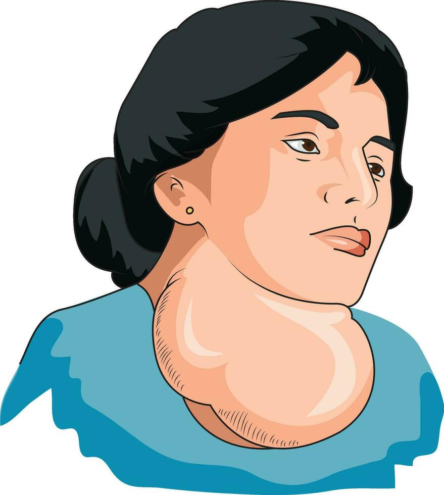 Woman suffering from goitre vector