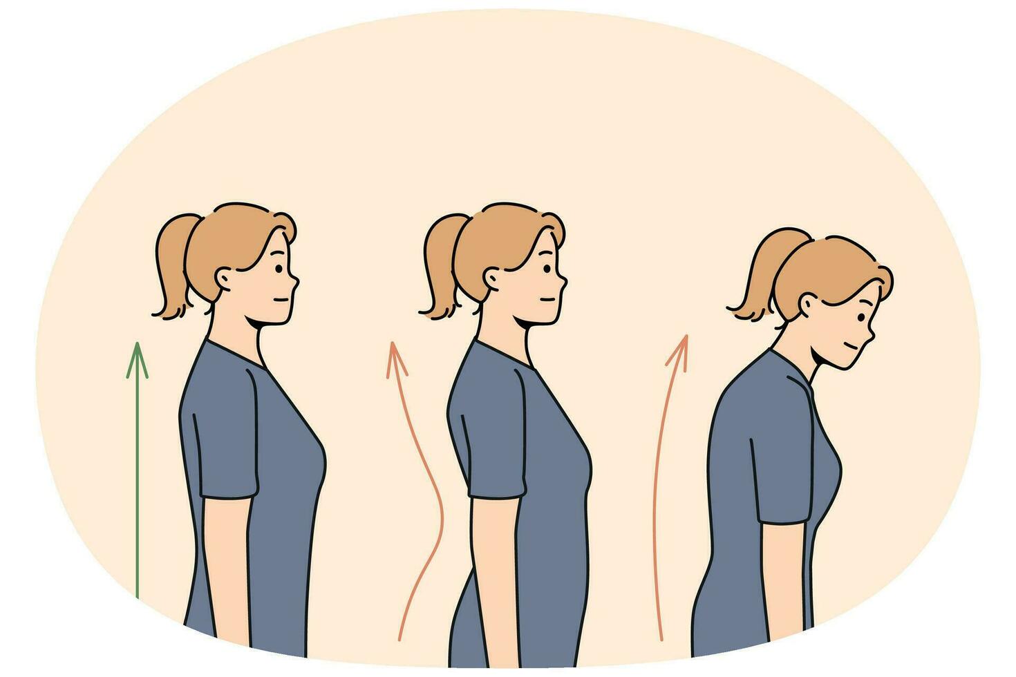 Set of young woman posture problems vector