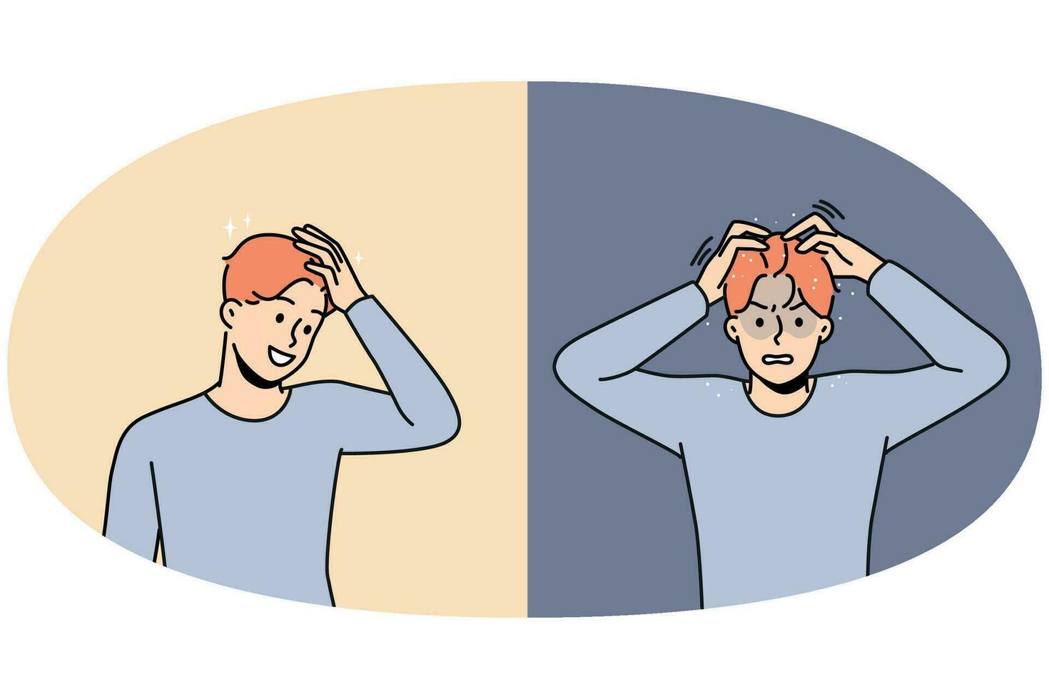Young man before and after dandruff treatment vector
