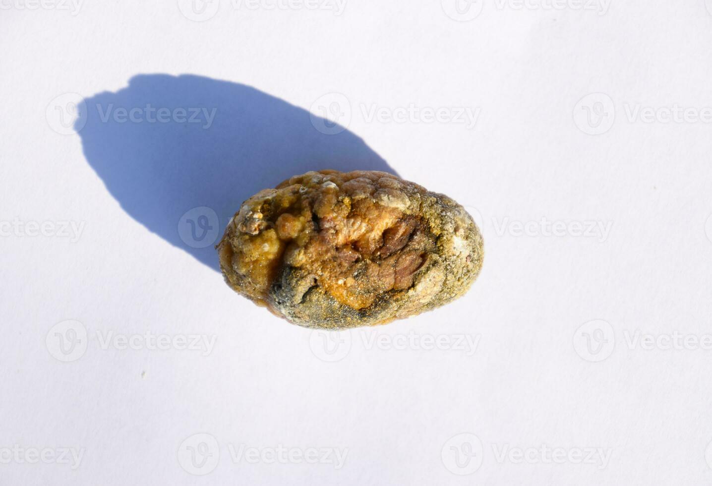 Stone of gallbladder. The result of gallstones. A calculus of heterogeneous composition. photo