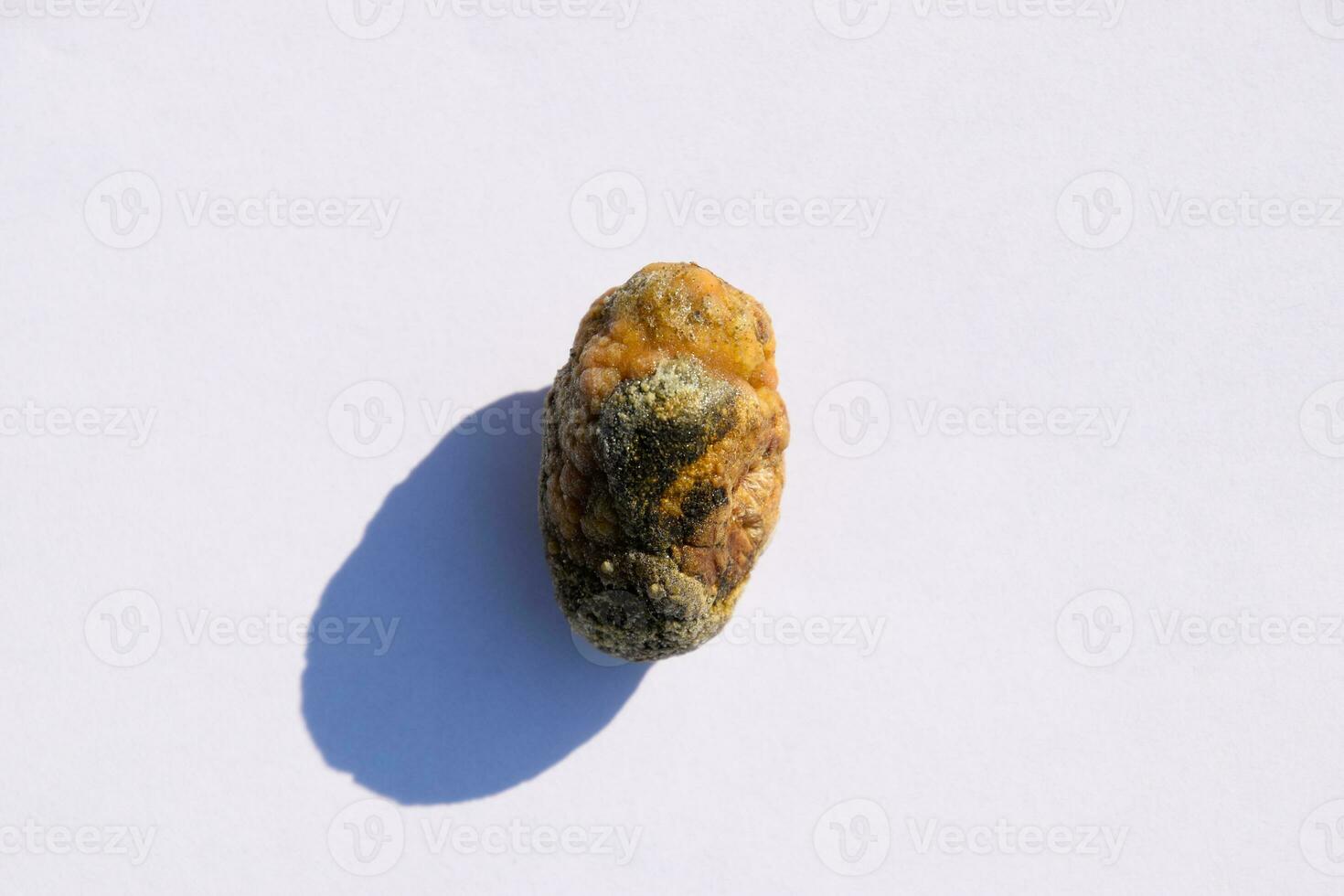 Stone of gallbladder. The result of gallstones. A calculus of heterogeneous composition. photo