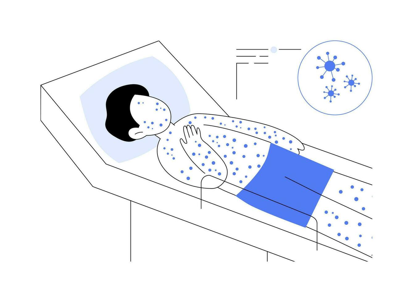 Chickenpox abstract concept vector illustration.