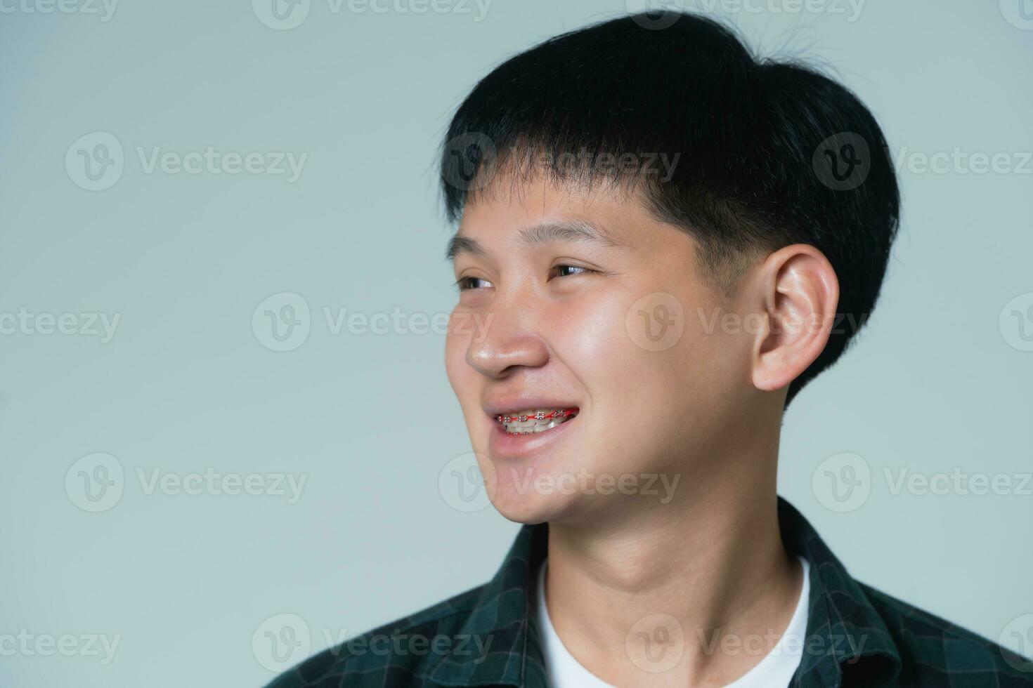 Asian man braces. Teeth braces on the white teeth of man to equalize the teeth. Bracket system in smiling mouth, close up photo teeth, macro shot, dentist health concept.