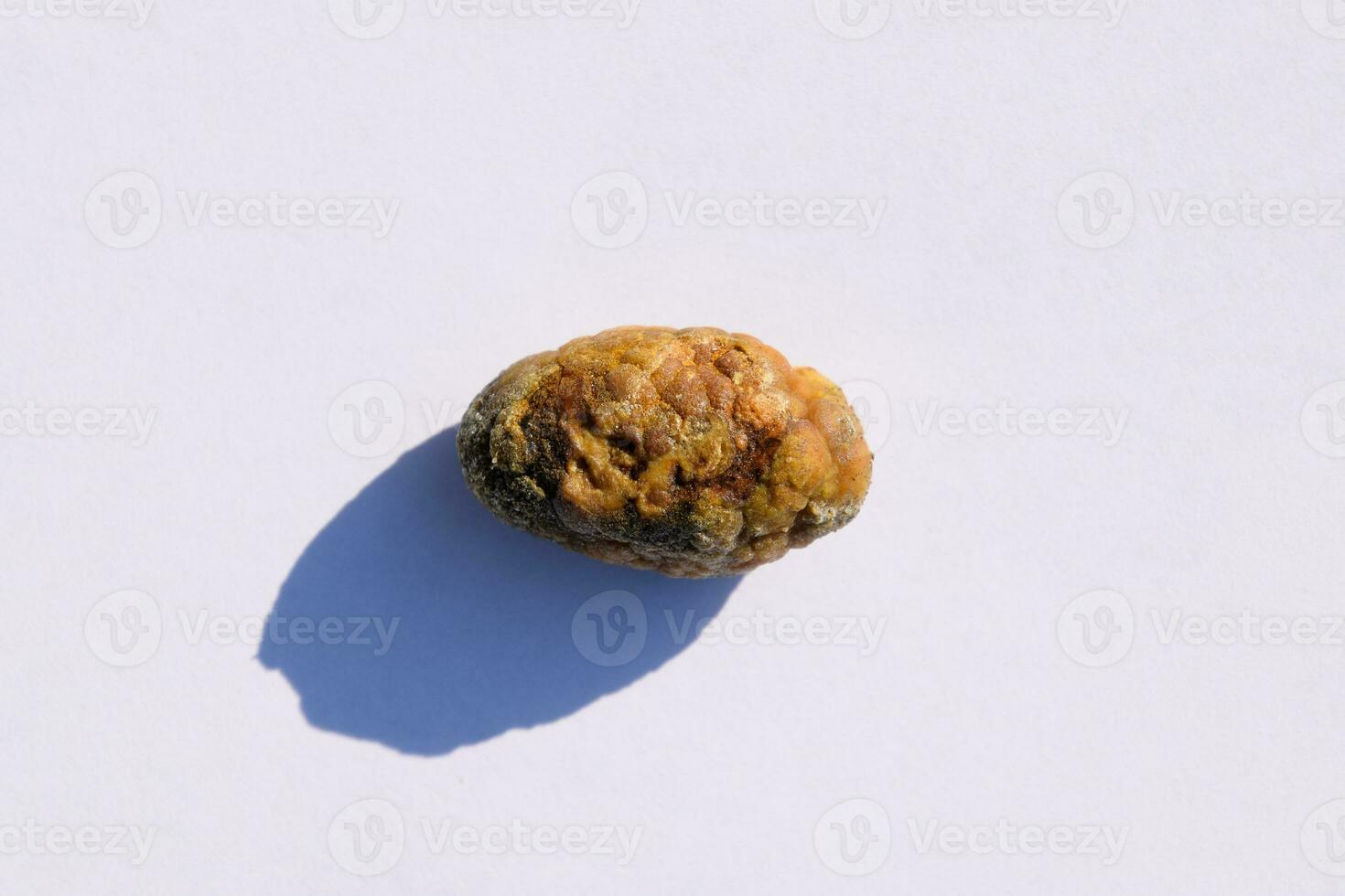Stone of gallbladder. The result of gallstones. A calculus of heterogeneous composition. photo