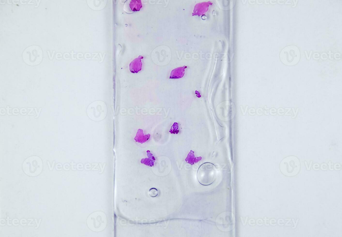 Slices of the tumor under glass. Histological examination of tumor cells for the presence of cancer photo