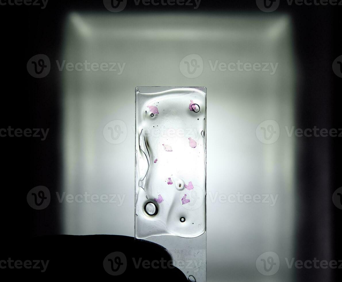 Slices of the tumor under glass. Histological examination of tumor cells for the presence of cancer photo