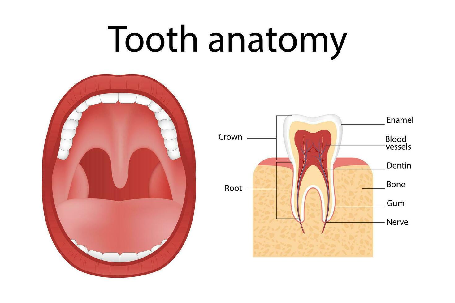 Dental implant. Realistic implant structure, graphic models of the crown. Screw prosthesis, orthodontic dental implantation vector