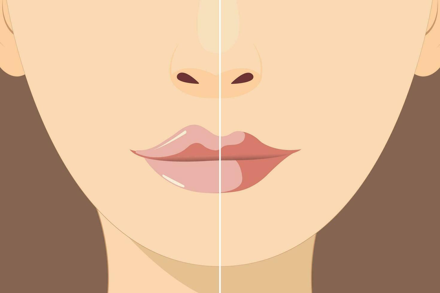 labio aumento y corrección. labio relleno inyecciones hialurónico ácido. cosmetología procedimiento en un belleza salón vector