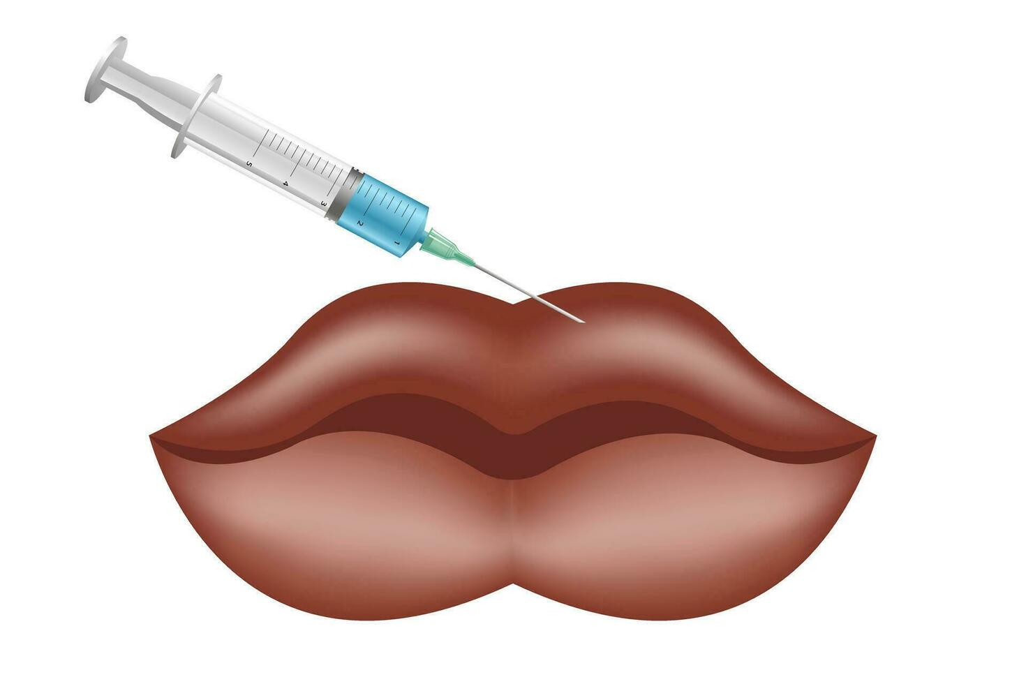 Lip augmentation and correction. Lip filler injections. Hyaluronic acid vector