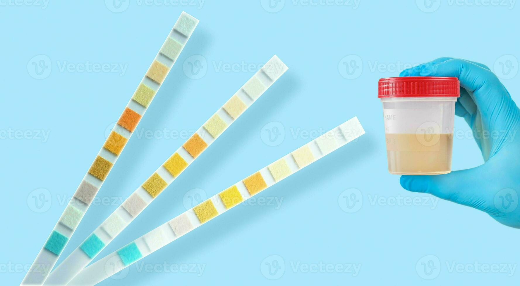 Hand holding urine sample container for medical urinalysis with color strip. photo