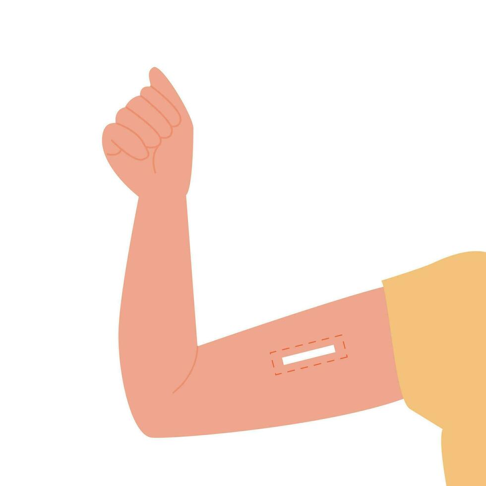 Contraception method. Vector flat female character with contraceptive implant inserted into arm. Birth control for women and pregnancy prevention. Illustration.