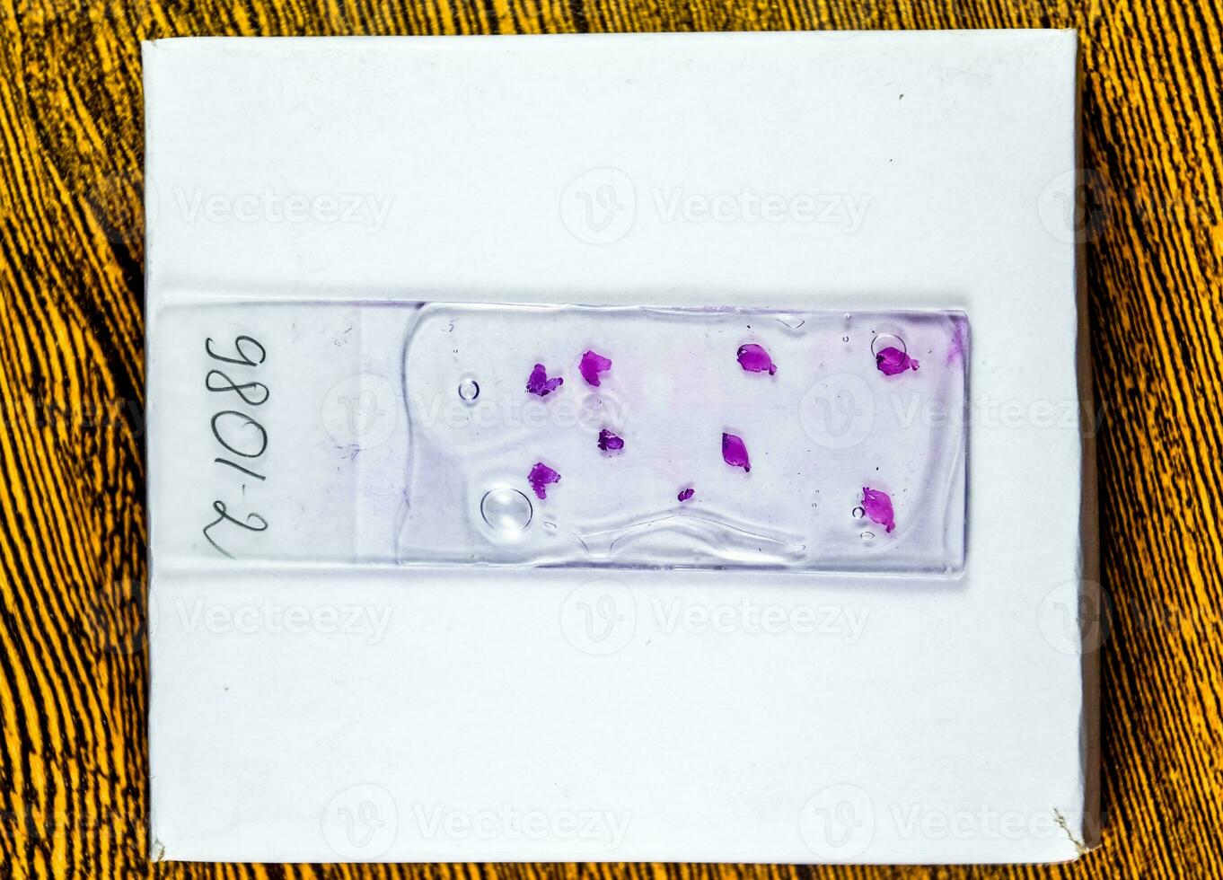 Slices of the tumor under glass. Histological examination of tumor cells for the presence of cancer photo