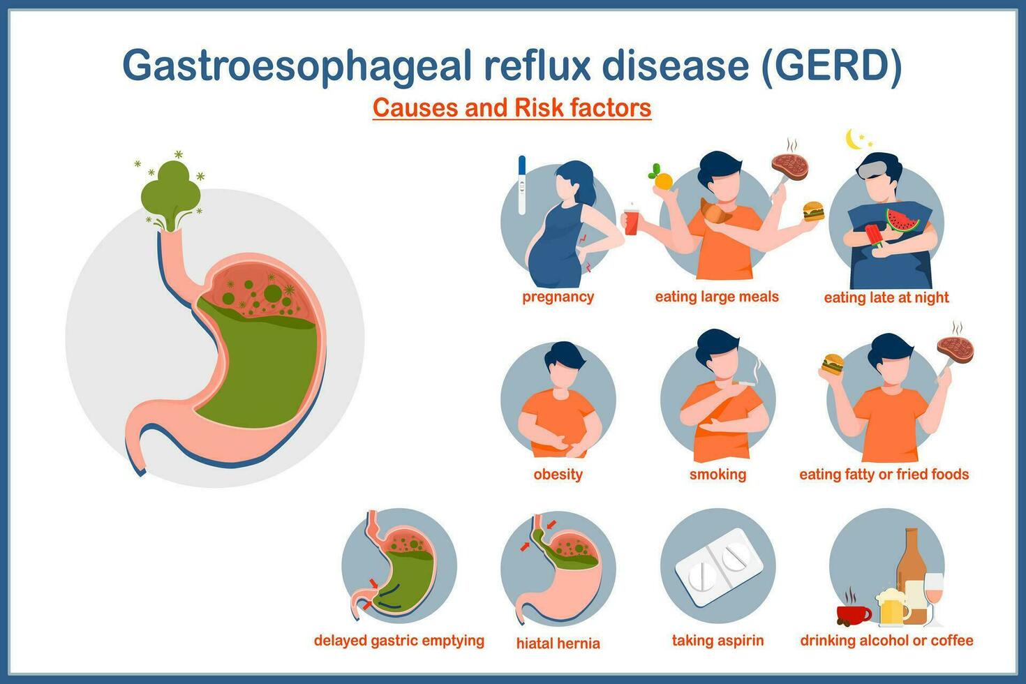 médico vector ilustración en plano estilo.causas y riesgo factores de gerd.embarazo,obesidad,fumar,comer grande comidas, comer tarde a noche, hiato hernia, retrasada gástrico vaciar, beber alcohol.