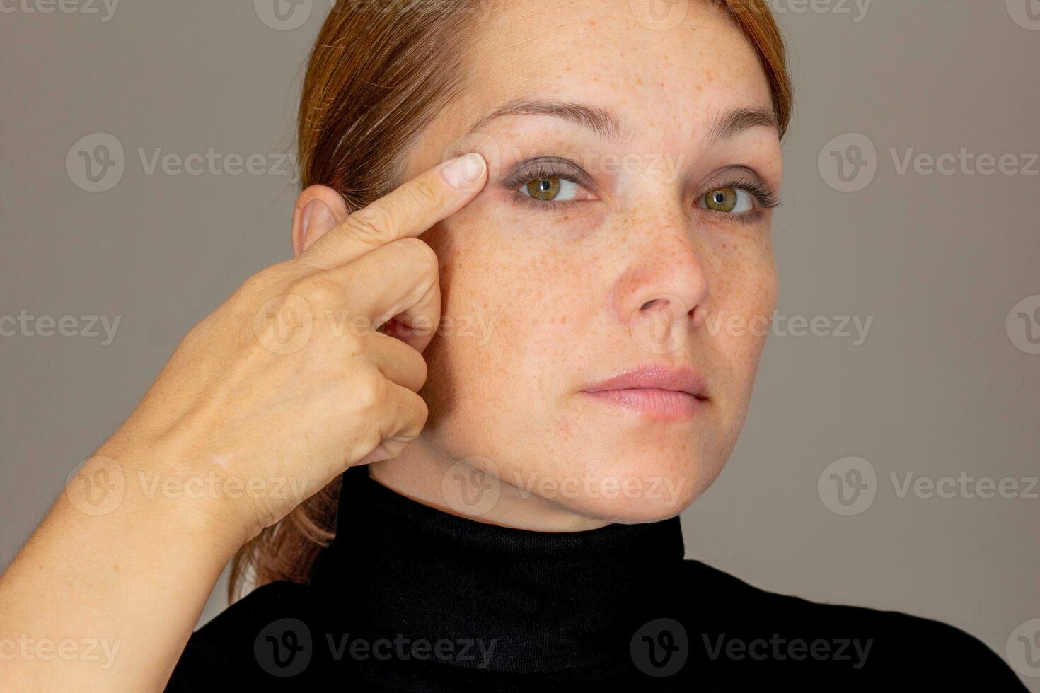 Portrait of cropped caucasian middle aged woman face with freckles showing on eyelid by finger photo