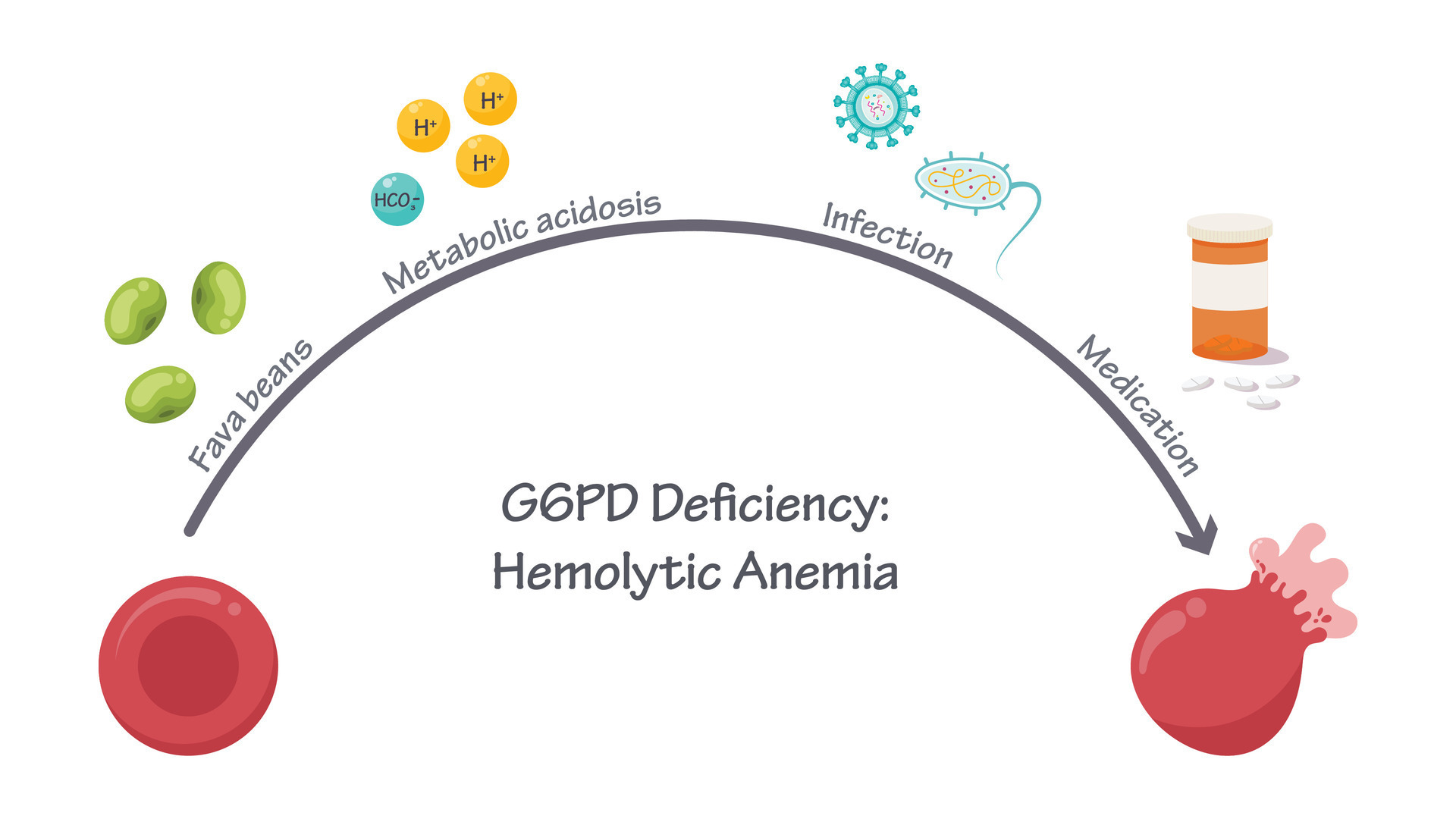 G6PD Deficiency Hemolytic Anemia medical vector illustration graphic