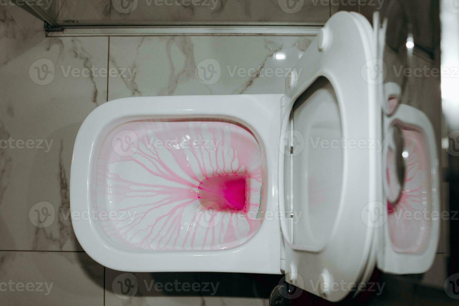 Clean the toilet for cleanliness and hygiene. cleaning the toilet. Cleaning service concept. Chemistry for the toilet is pink photo