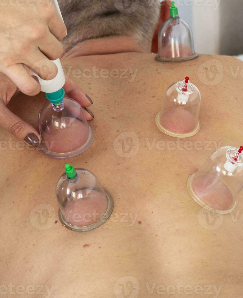 Disparo de el hembra médico en uniforme en contra el blanco pared examinando medio años masculino paciente, ejecutando utilización de tazas terapia. cuidado de la salud foto