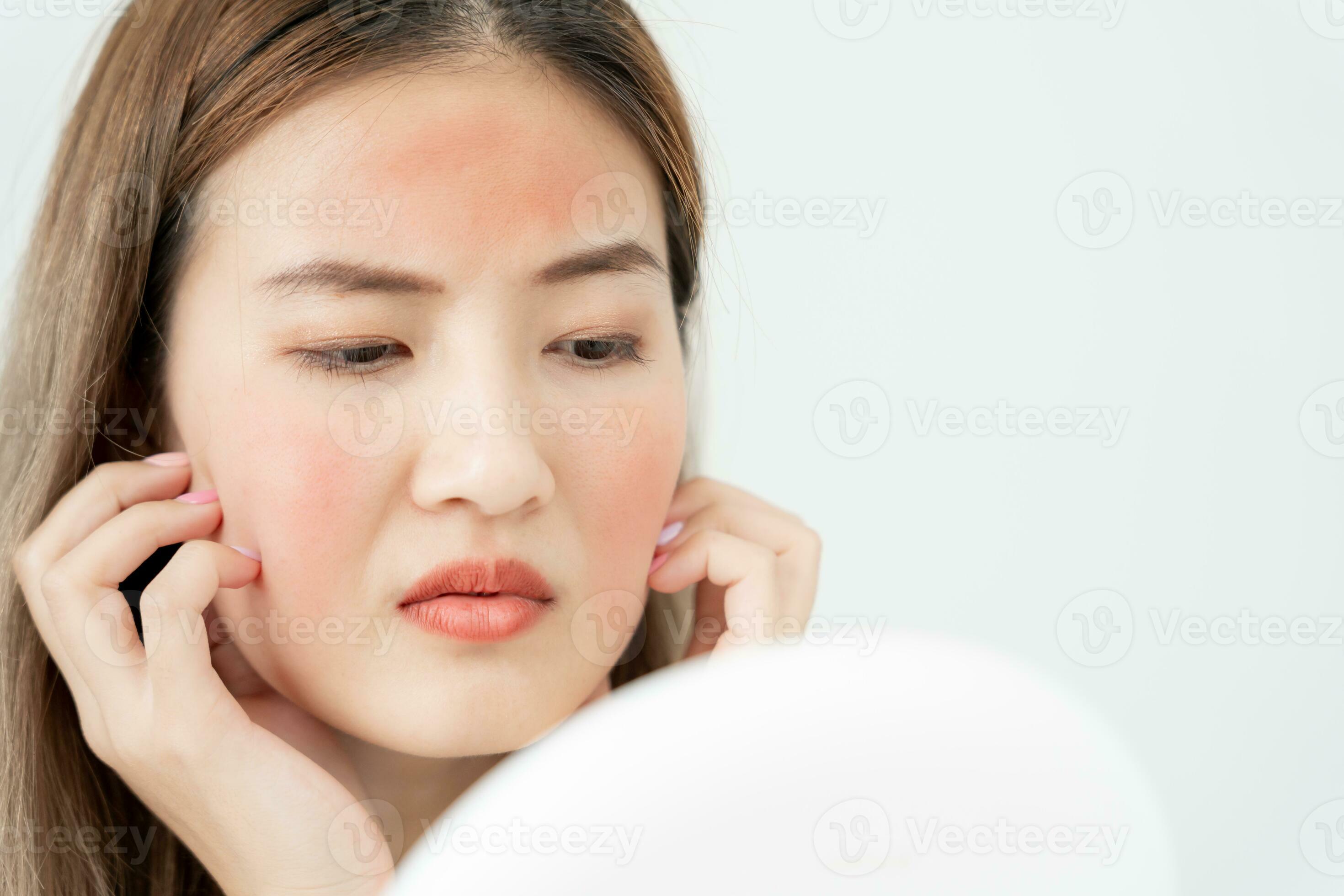 Young woman asian are worried about faces Dermatology and allergic to