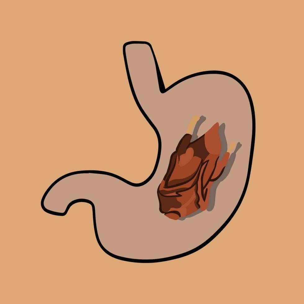 Vector isolated illustration of meat digestion. Overeating on holidays. Turkey digestion. Thanksgiving meal. Turkey in the stomach. Problems with digestion.