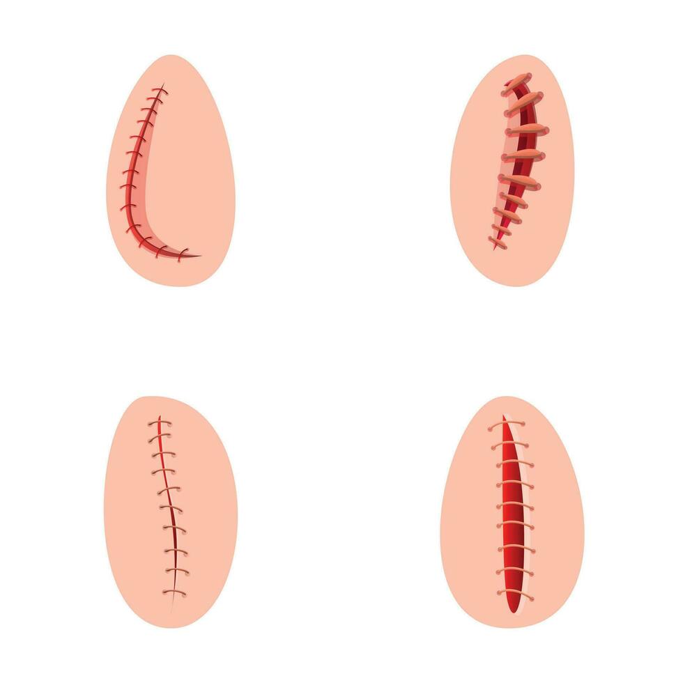 operando sutura íconos conjunto dibujos animados vector. varios tipo de quirúrgico sutura vector