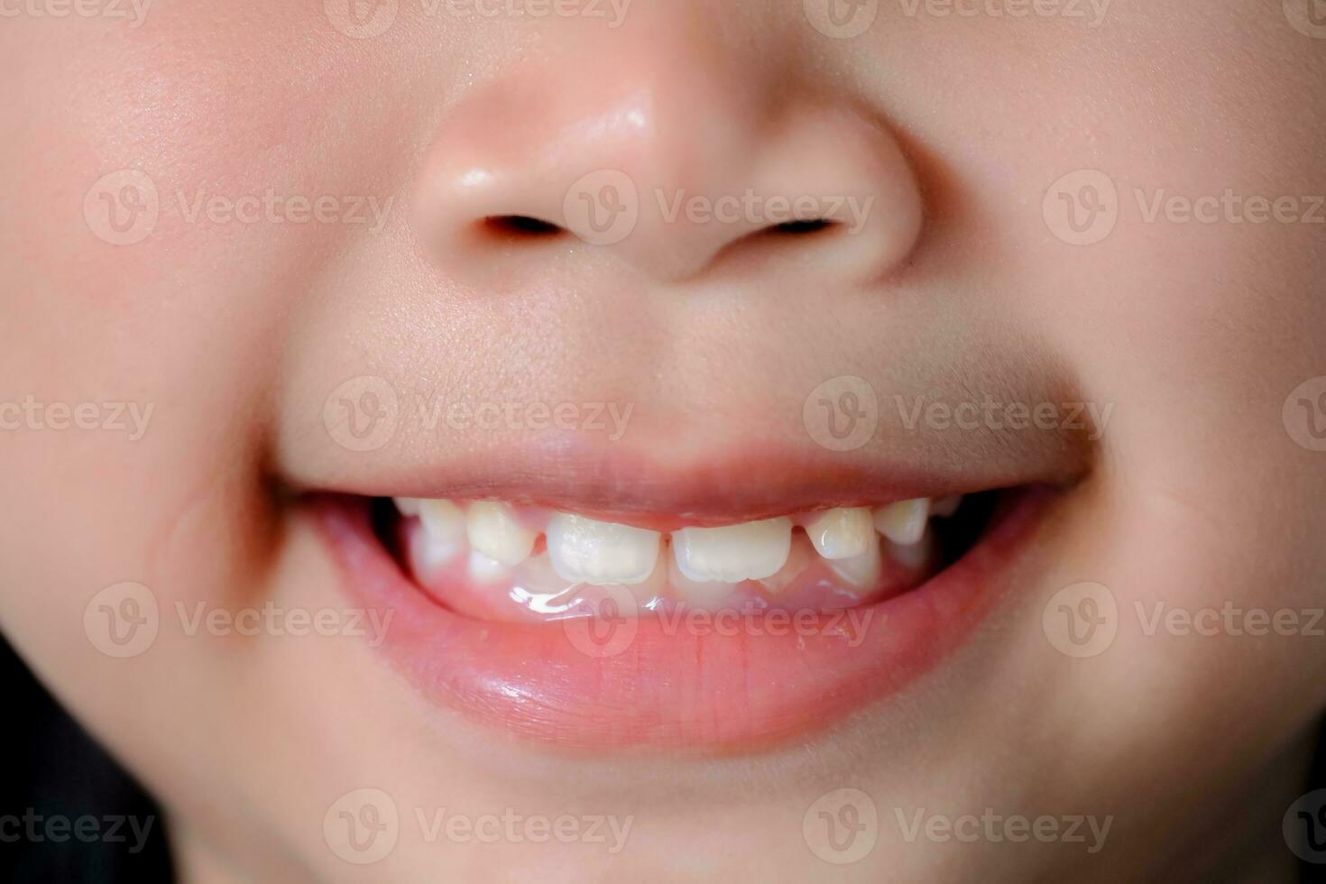 cerca arriba de un linda asiático niña sonriente felizmente demostración su frente dientes. contento vida concepto foto