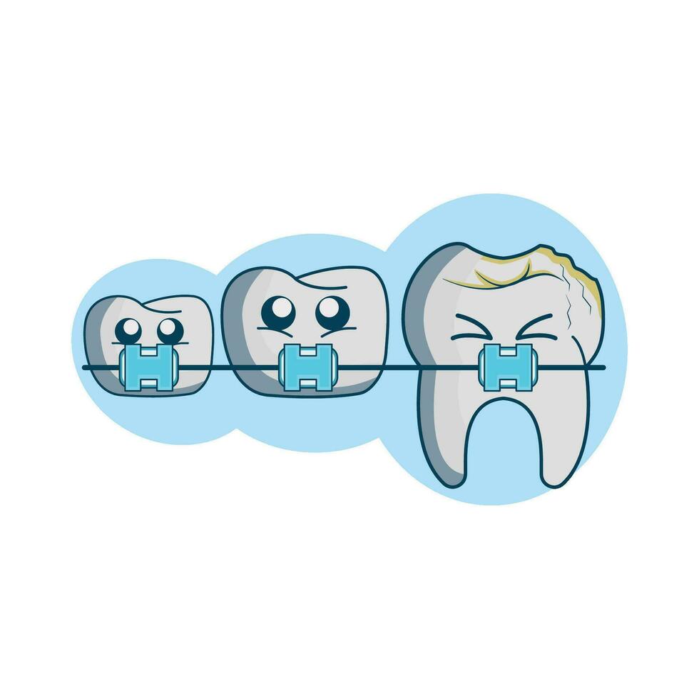 ilustración de dientes con tirantes vector