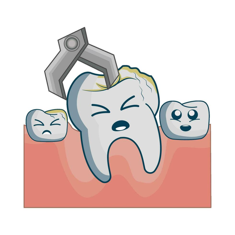 illustration of tooth extraction vector