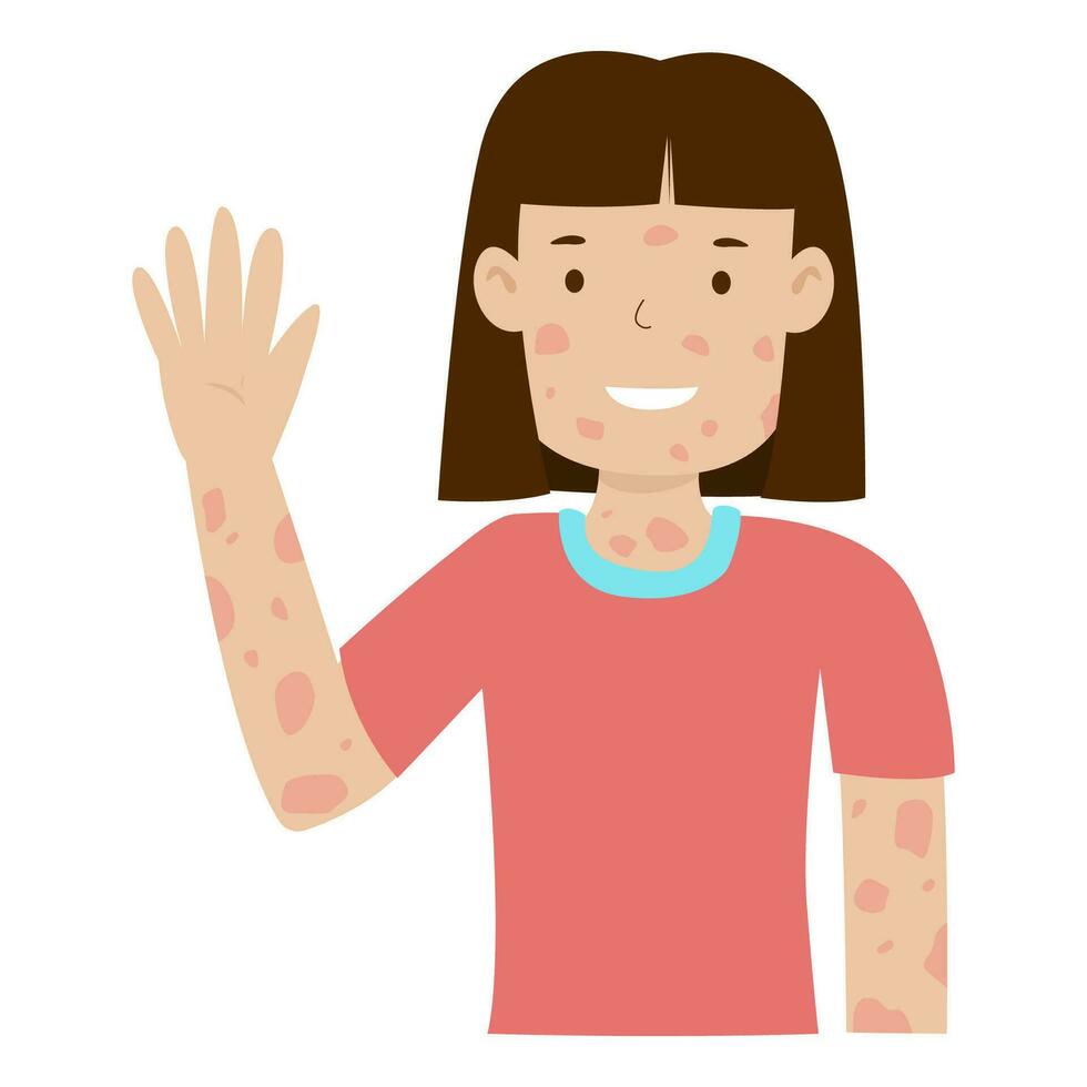 mujer con lepra enfermedad sonrisa y brazos elevado vector