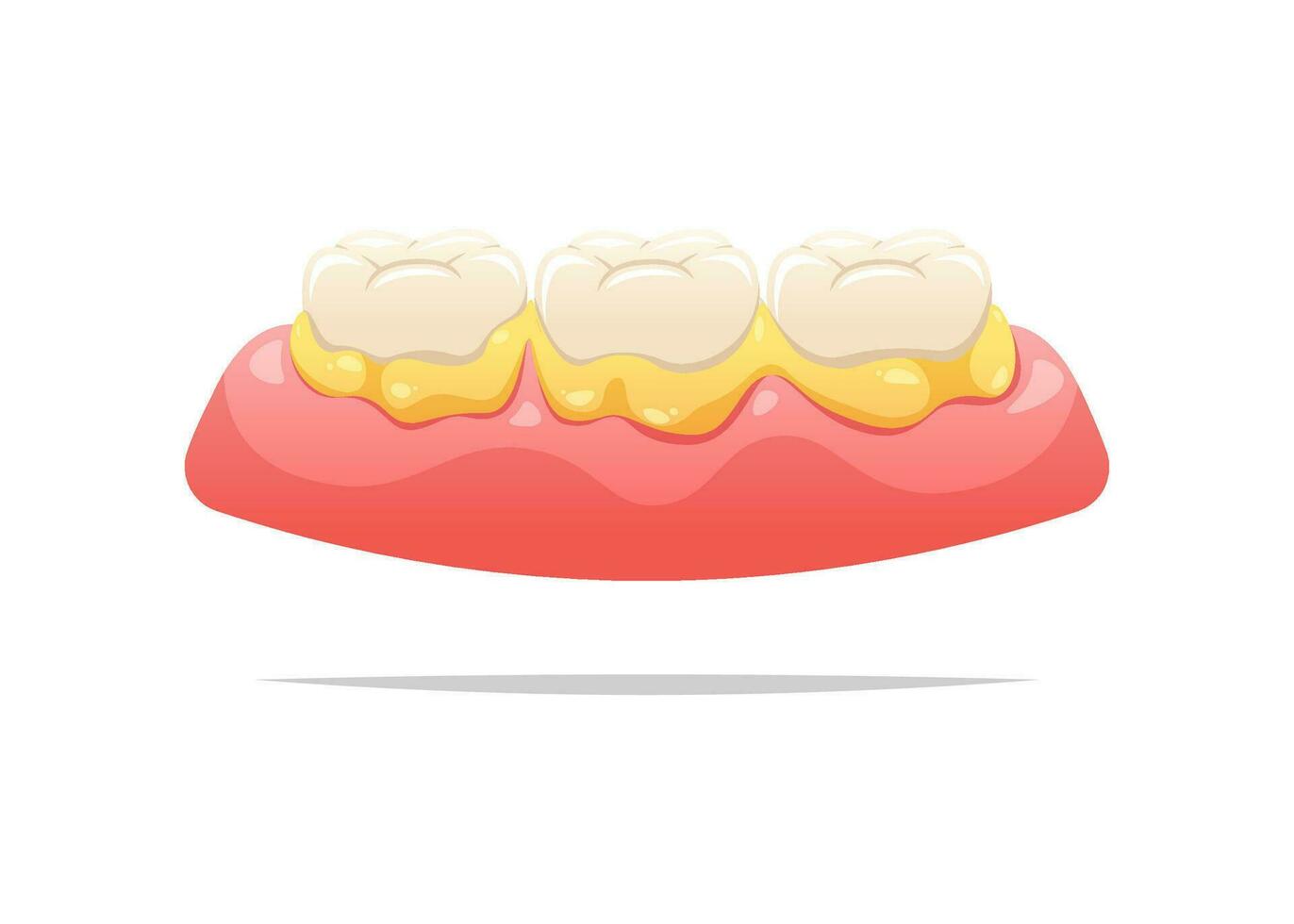 placa en dientes y cena. dental salud concepto. vector ilustración.