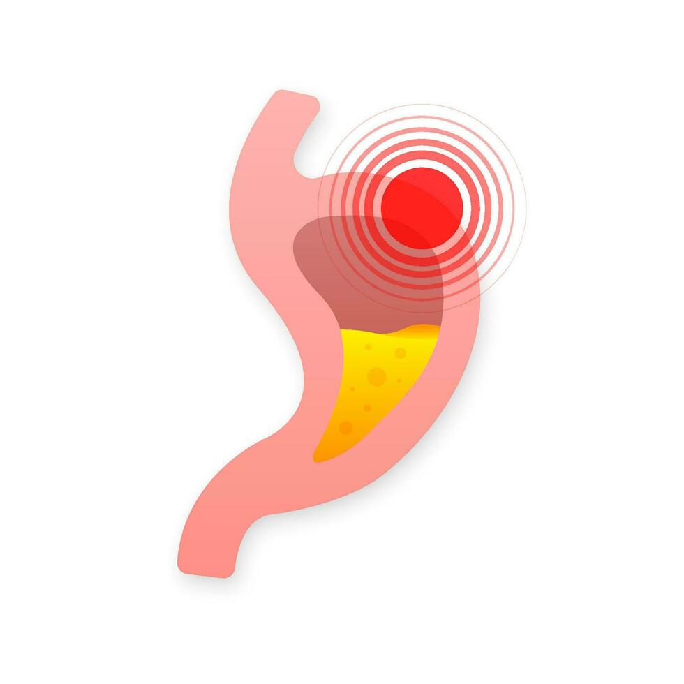 Human stomach. Healthy and unhealthy. Digestive system anatomy. Vector stock illustration.