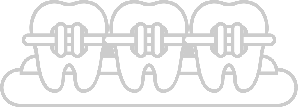 Braces vector
