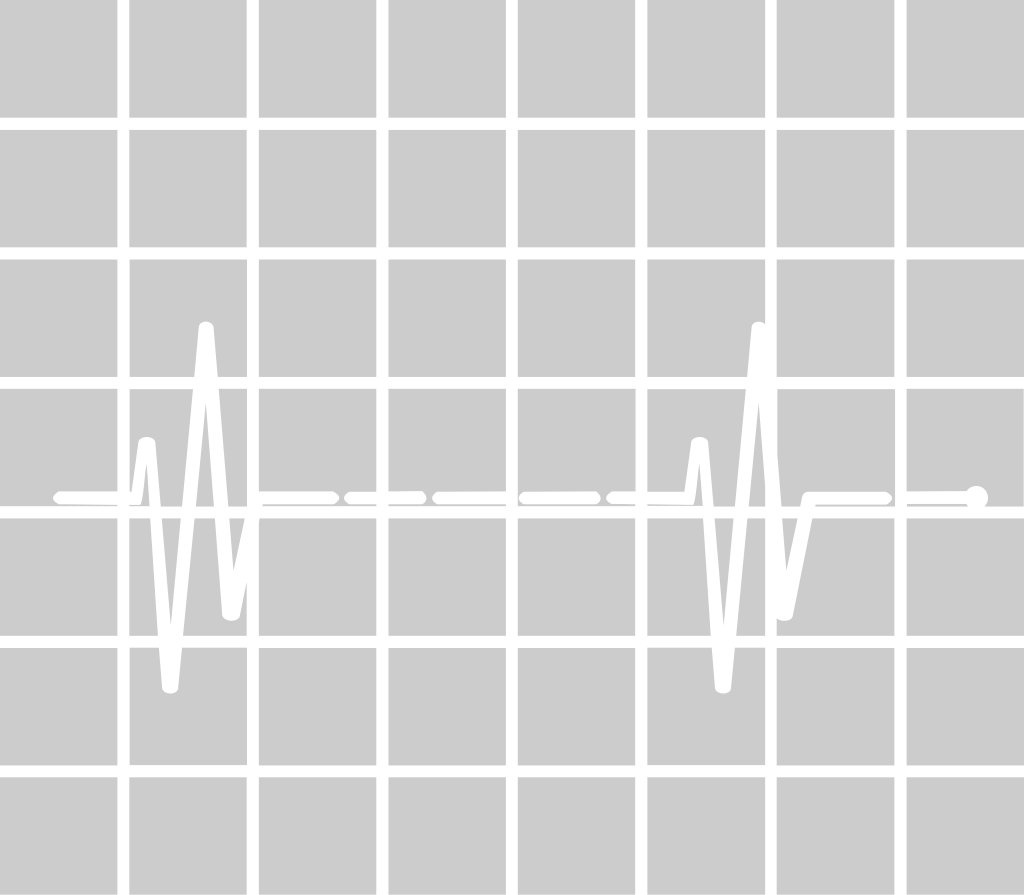 Heartbeat with grid vector