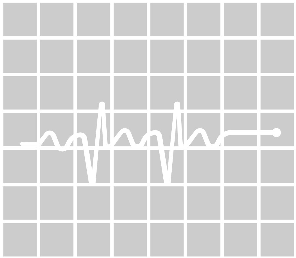 Heartbeat with grid vector