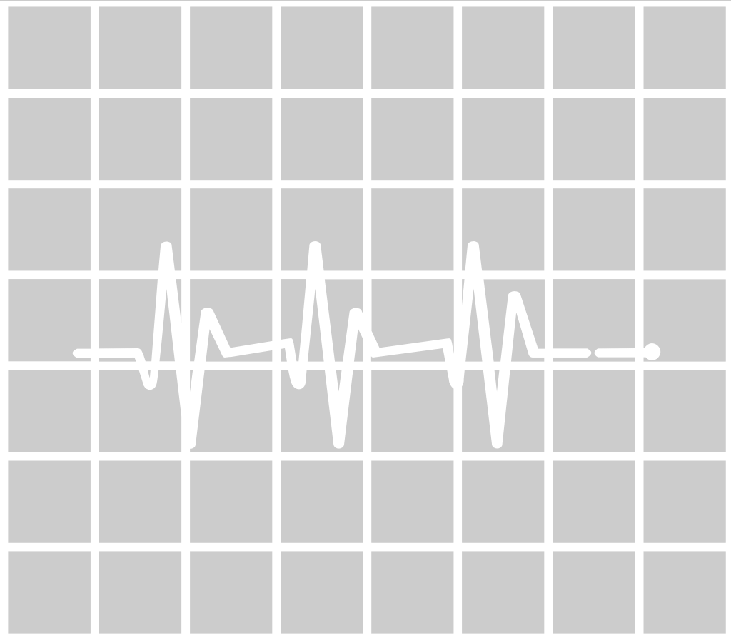 Heartbeat with grid vector