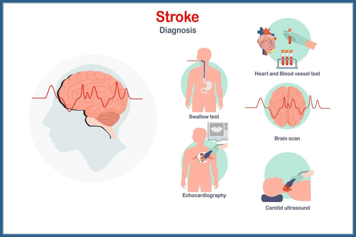 Healthcare concept illustration.Vector in flat style of stroke diagnosis, brain scan, heart and blood vessels test, echocardiography, carotid ultrasound.science illustrations. vector