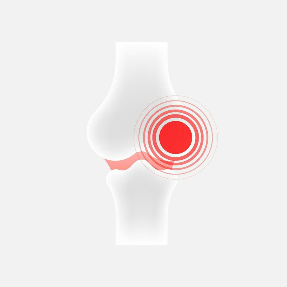 Infographic with joint pain. Human knee bone joint line icon vector