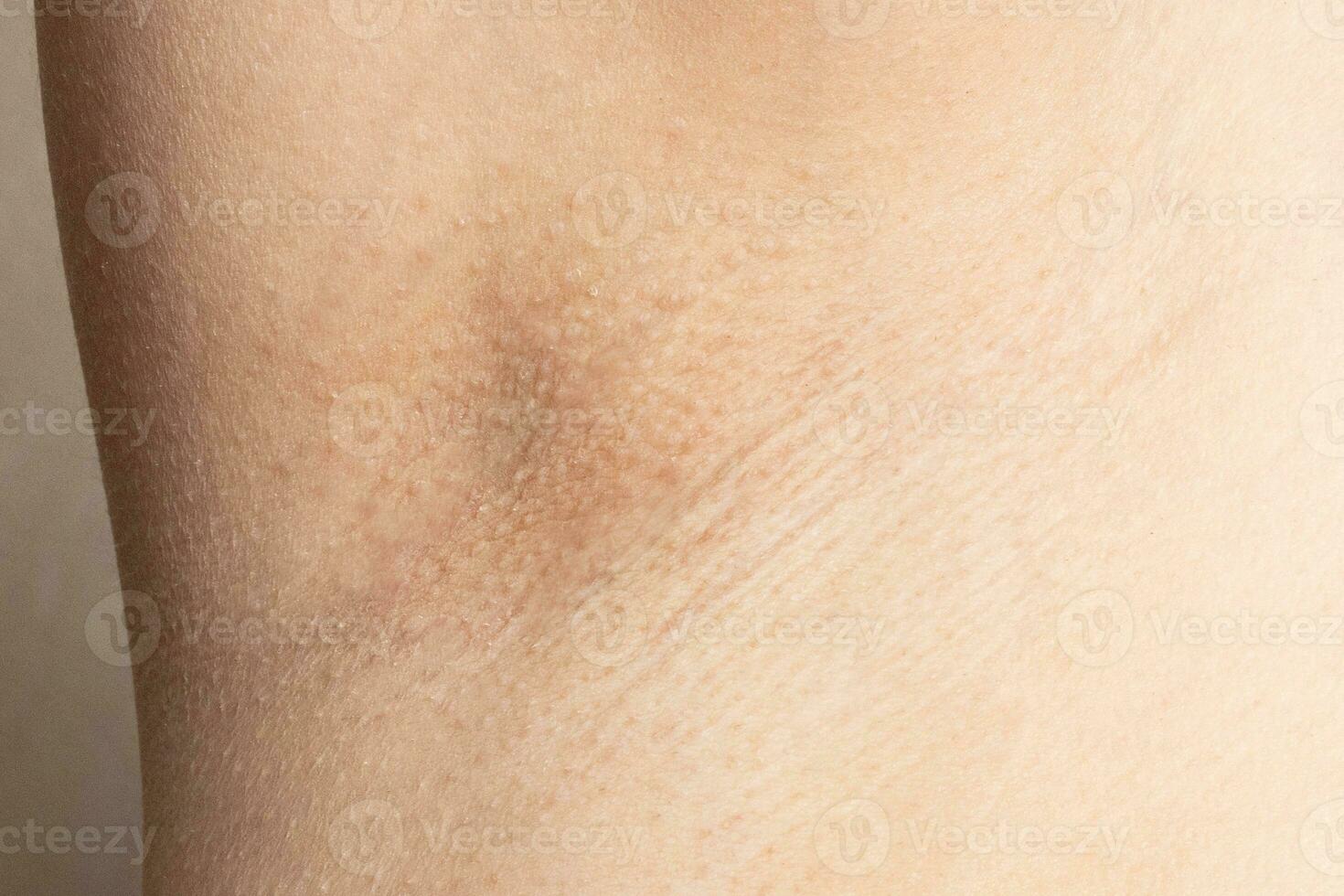 armpit female closeup woman under arm before hair removal photo