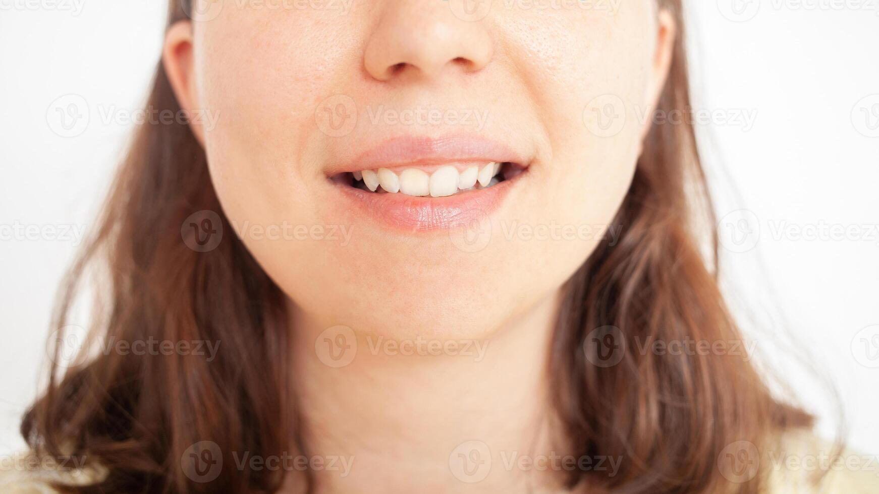 mujer sonrisas, blanco dientes después cepillado foto