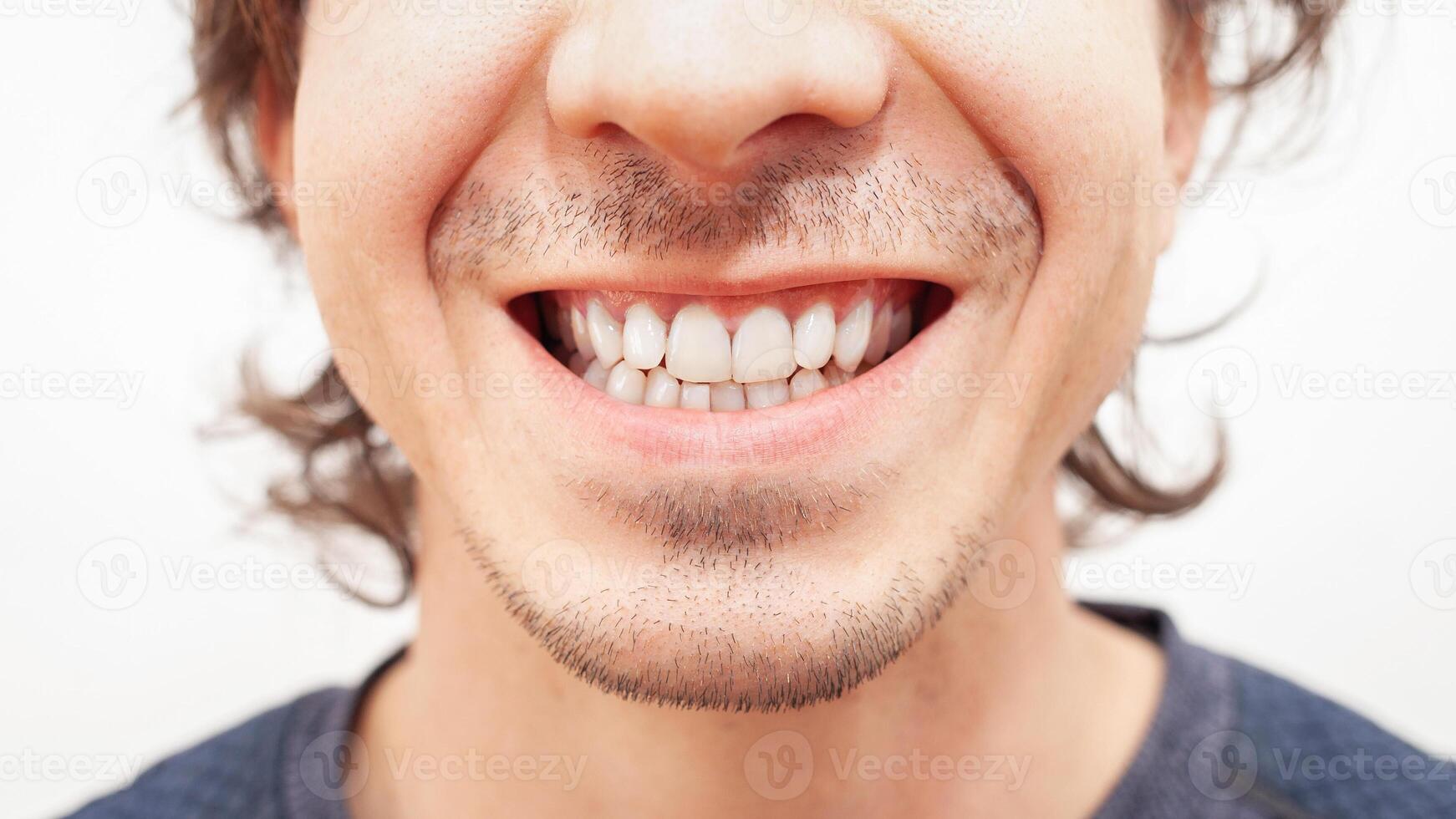 cerca arriba retrato sonrisa dientes hombre. blanco hermosa dientes después blanqueo, alineación foto