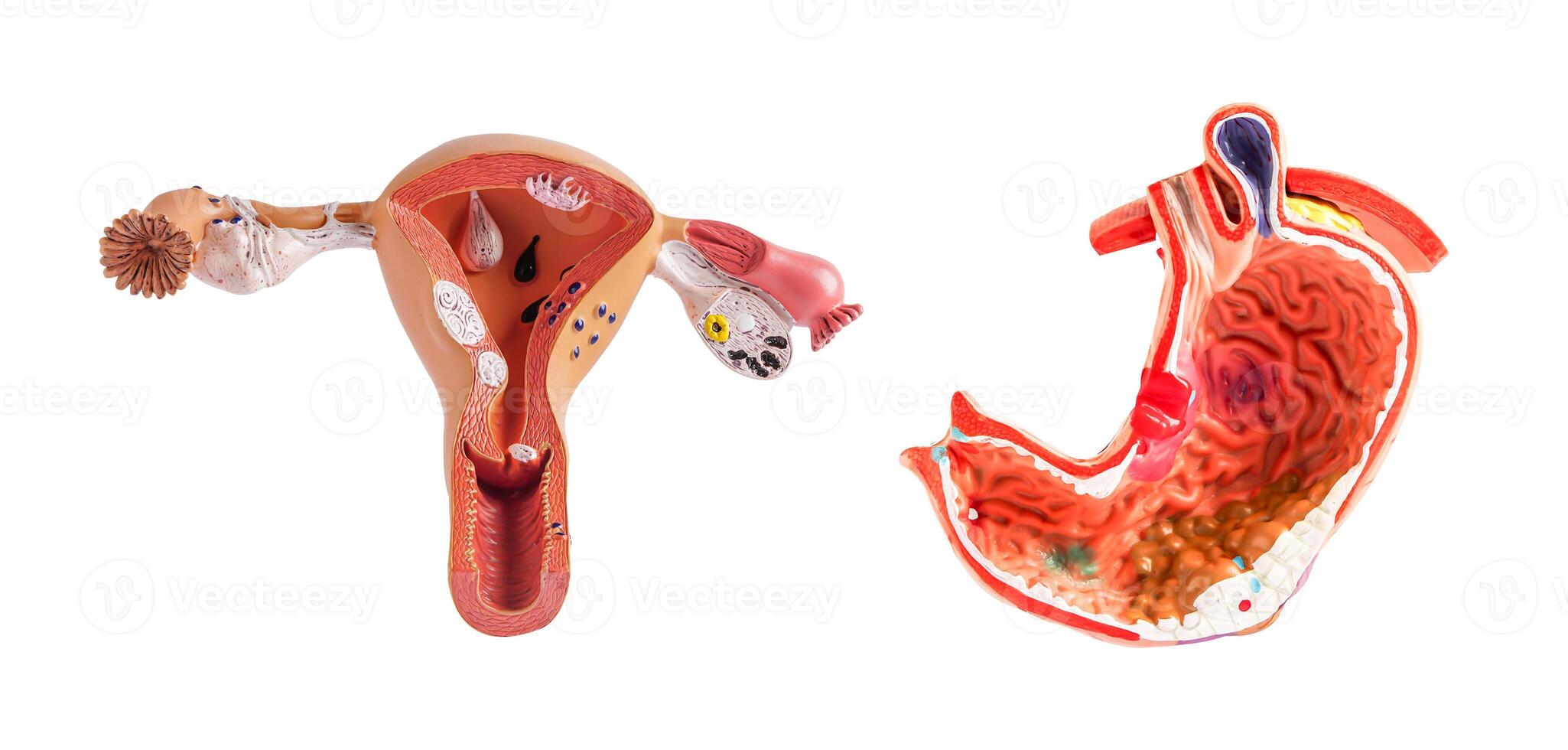 Uterus and stomach model isolated on white background, doctor holding anatomy model for study diagnosis and treatment in hospital. photo