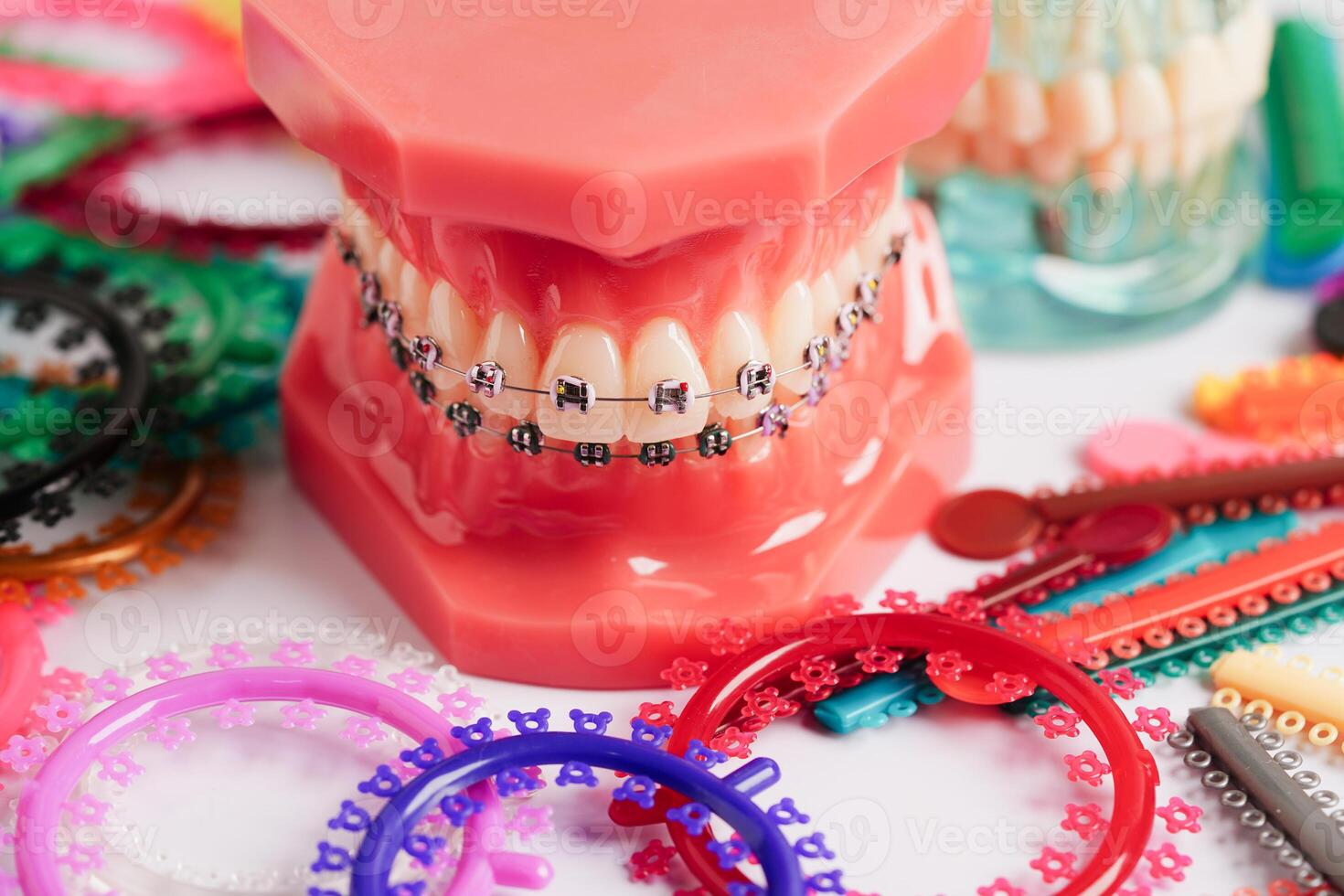 Orthodontic ligatures rings and ties, elastic rubber bands on orthodontic braces, model for dentist studying about dentistry. photo