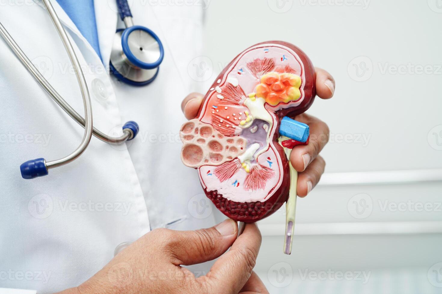 Chronic kidney disease, doctor with model for treatment urinary system, urology, Estimated glomerular filtration rate eGFR. photo