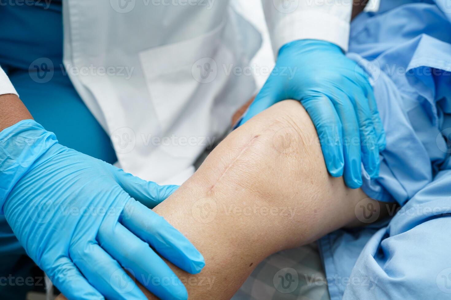 Doctor checking Asian elderly woman patient with scar knee replacement surgery in hospital. photo