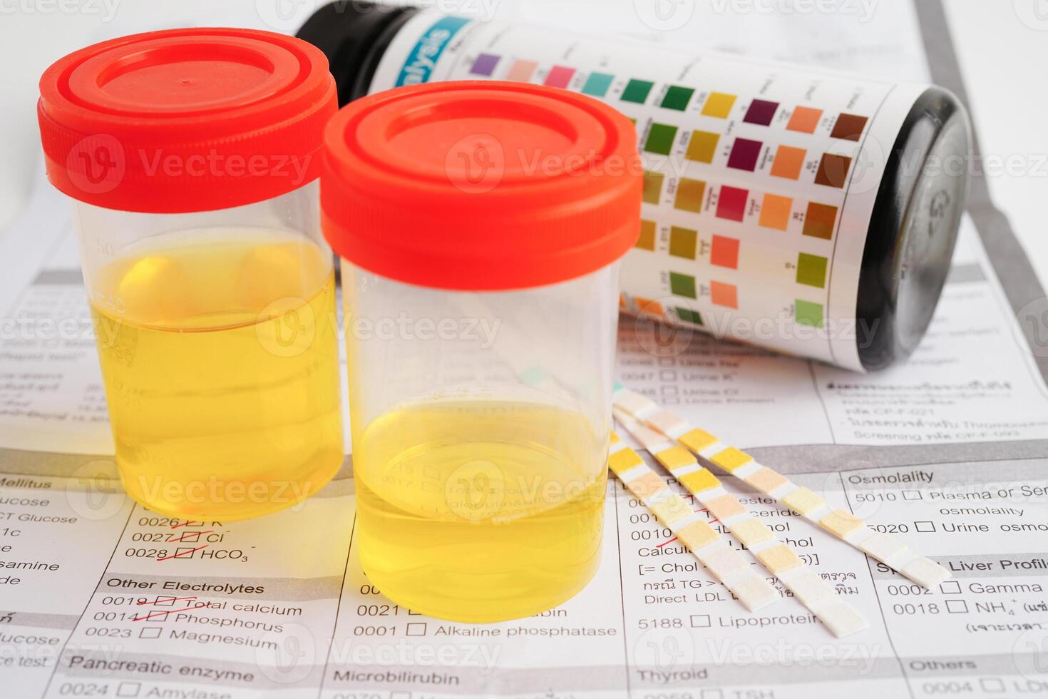 Urinalysis, urine cup with reagent strip pH paper test and comparison chart in laboratory. photo