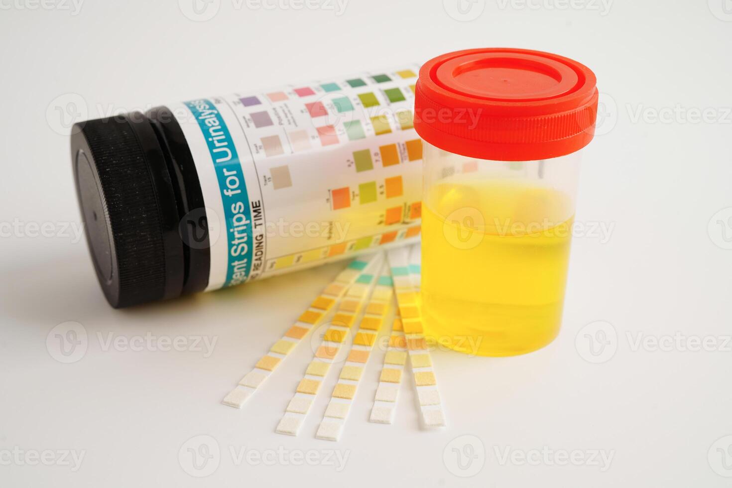 Urinalysis, urine cup with reagent strip pH paper test and comparison chart in laboratory. photo