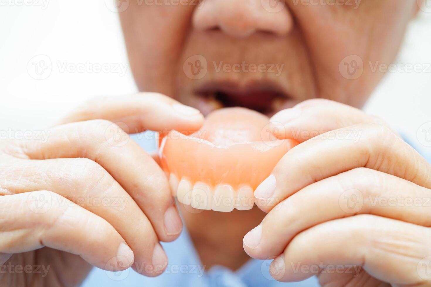 Asian senior woman patient holding teeth denture in her hand for chew food. photo