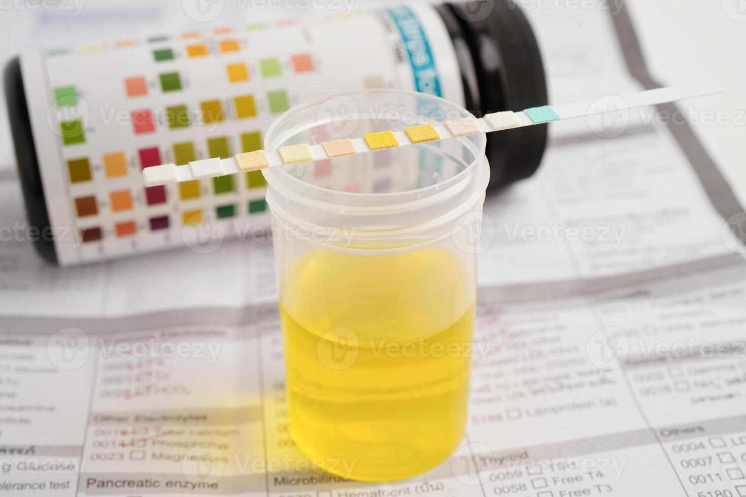 Urinalysis, urine cup with reagent strip pH paper test and comparison chart in laboratory. photo