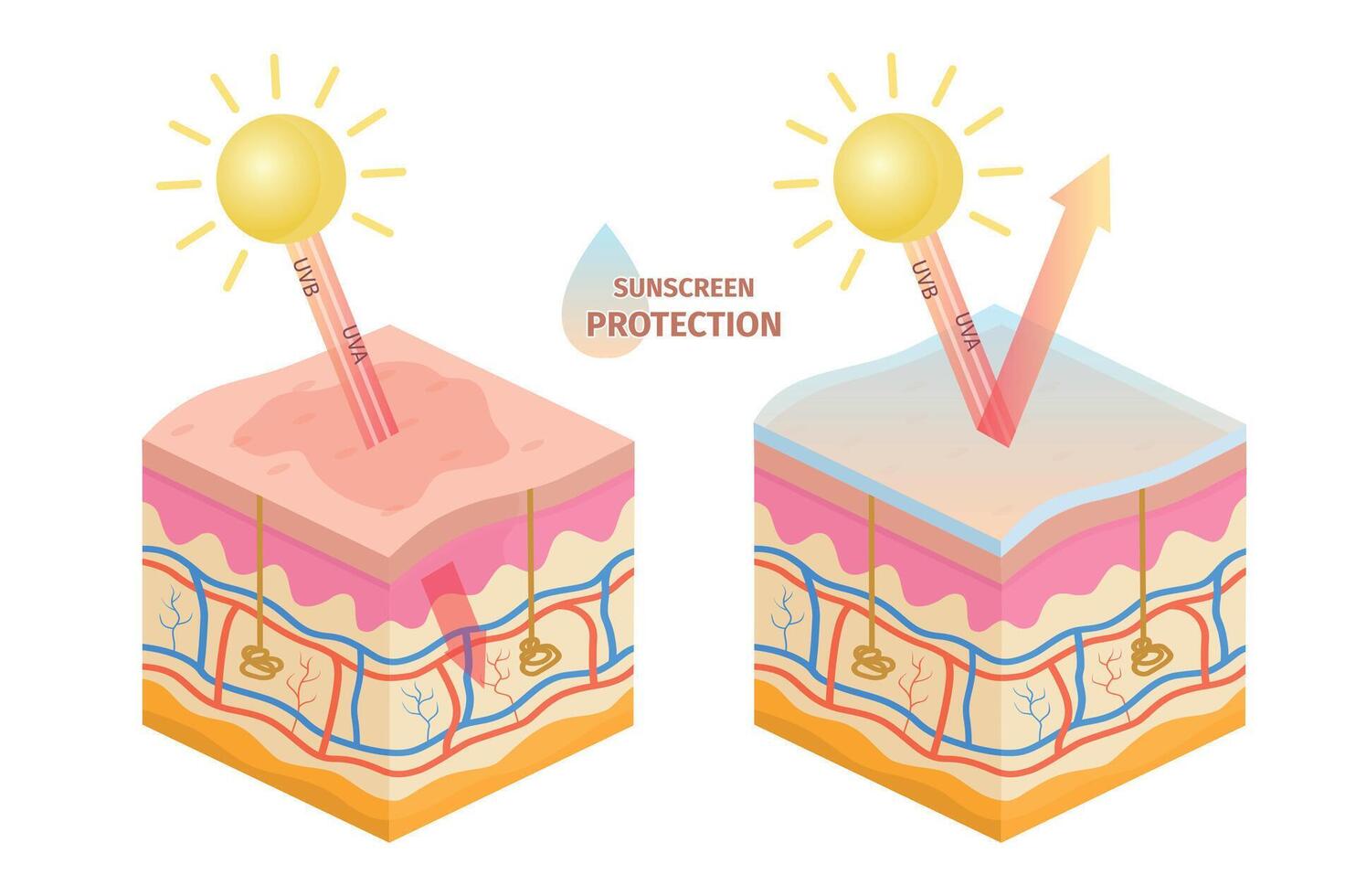 humano piel uv rayos proteccion, antes de y después protector solar Dom uva, uvb epidermis dañar prevención loción. piel bronceado vector infografía