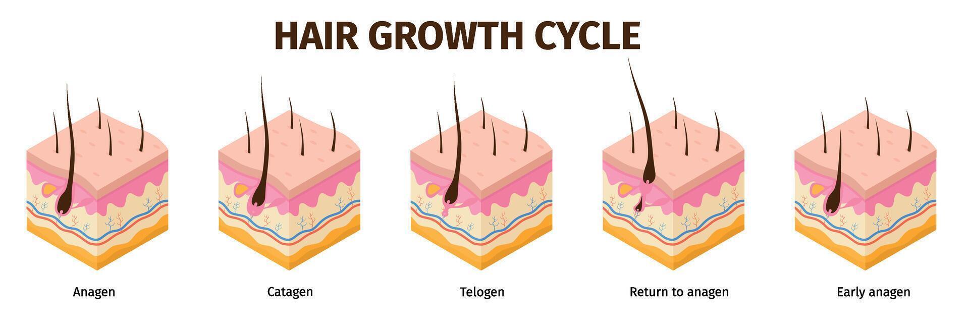 isométrica pelo folículo crecimiento ciclo pasos infografía. piel anatomía médico póster. pelo crecer anágeno, telógeno, catágeno etapas vector conjunto